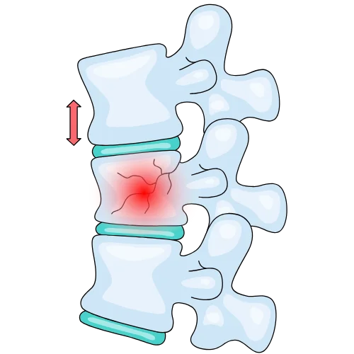 Spine Surgery Treatment